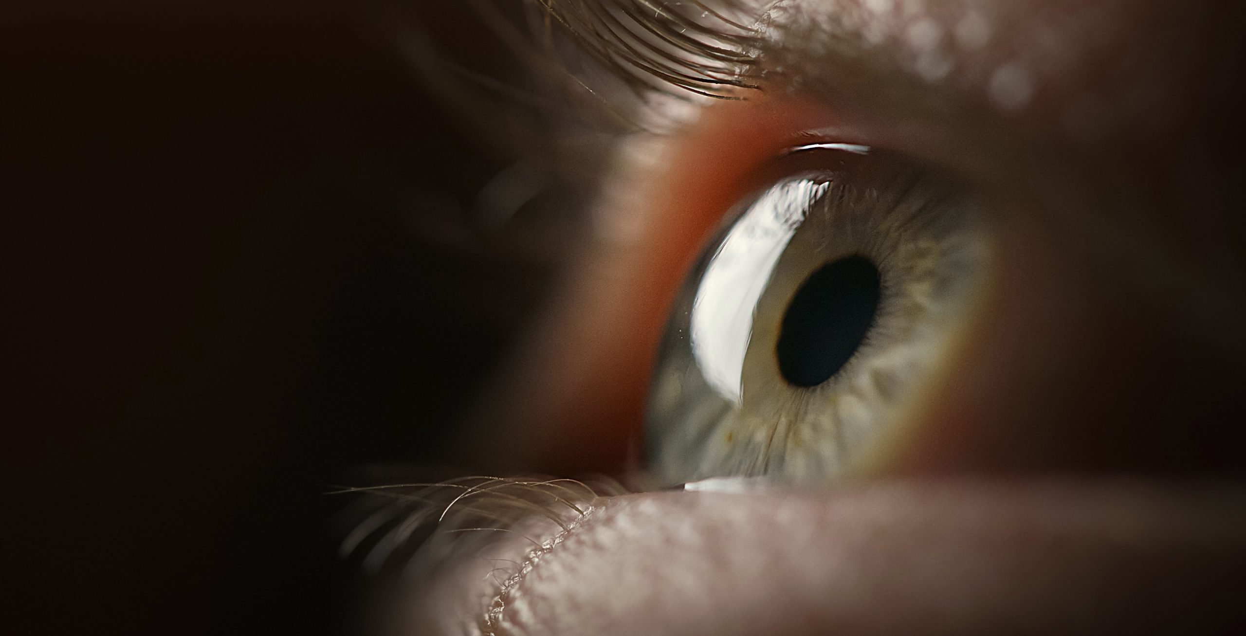 Revisão sistemática sobre rituximabe para doença do espectro da neuromielite óptica foi disponibilizada no e-natjus